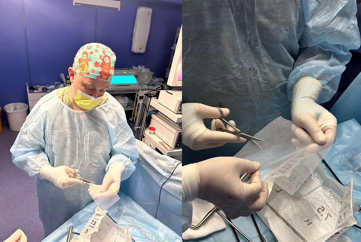 Подготовка сетчатого импланта.