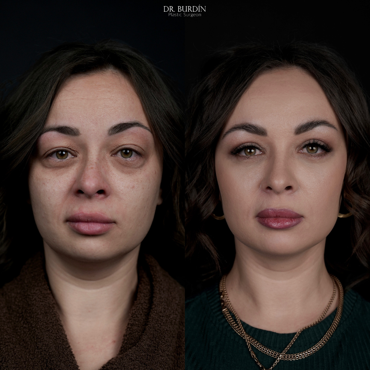 (работа пластического хирурга Бурдина С.А)