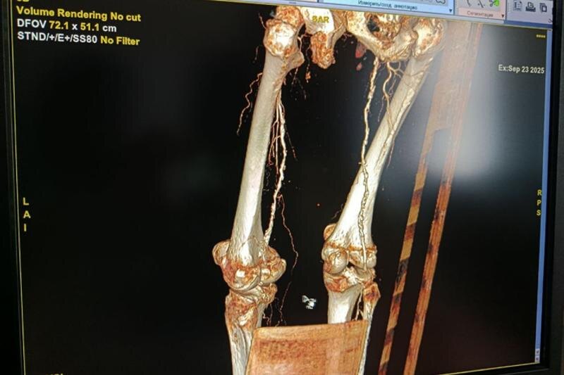    Пресс-служба АНО «Центральная клиническая медико-санитарная часть». Снимок ноги