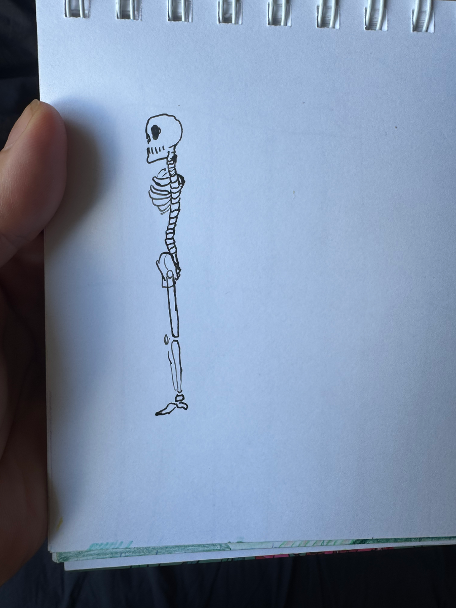 В ожирении ни изгибов здоровых ни арок не бывает, как у этого наглядного человечка. В анфас тоже деформаций хватает.