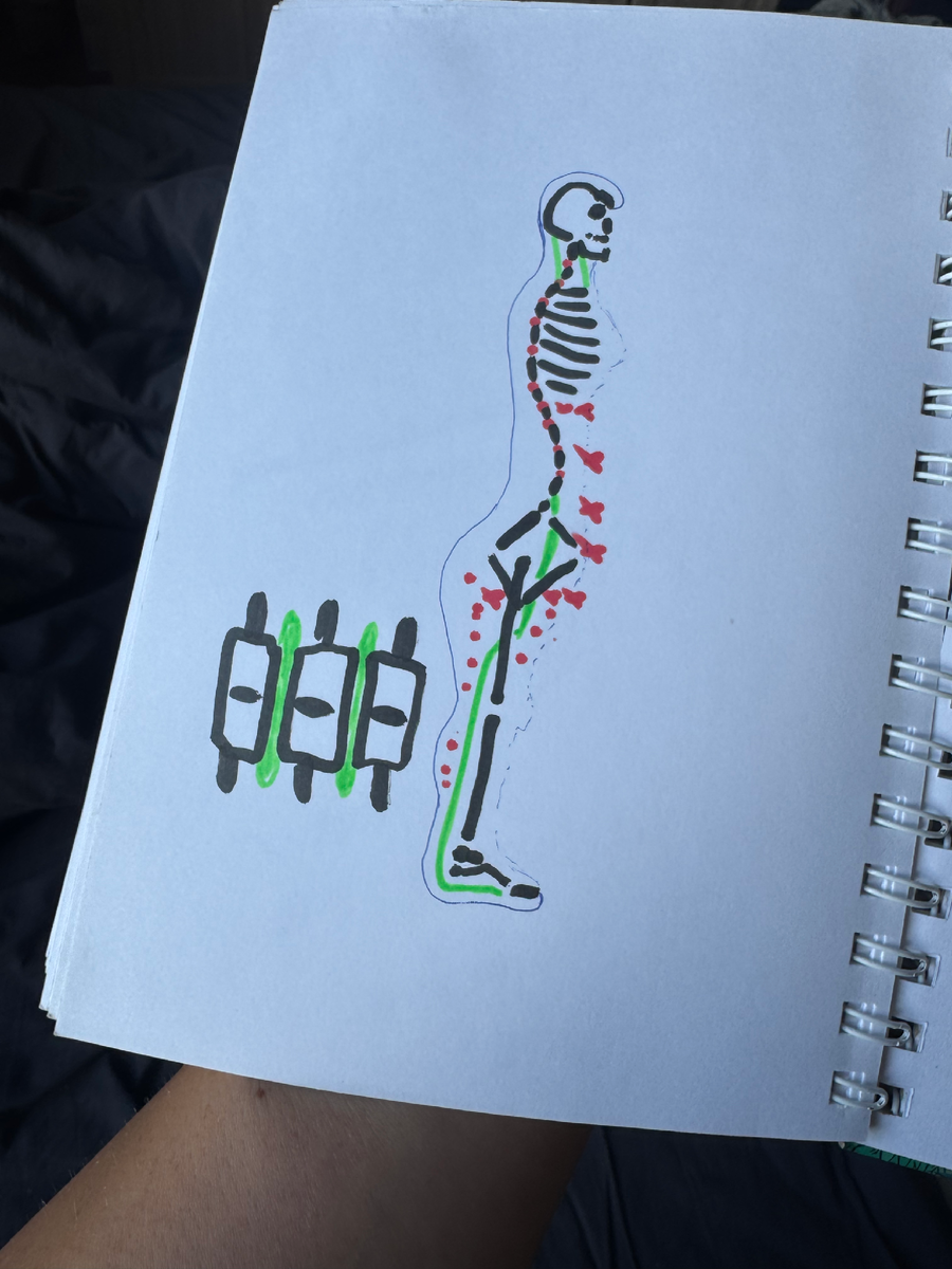 Ваши ткани все приделаны друг к другу, они не отдельные, и жир на животе через живот оттягивает за собой даже ваш позвоночник, который перекрестно деформируется по восходящей траектории. Как цепная реакция.