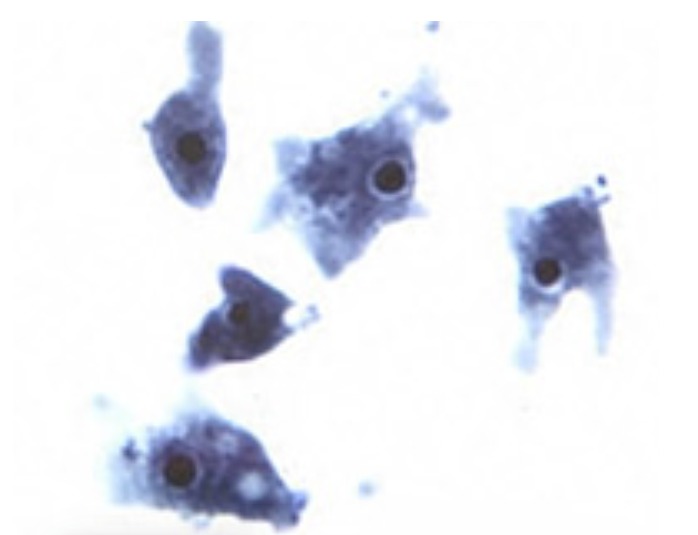 Неглерия Фоулера - фото из Википедии