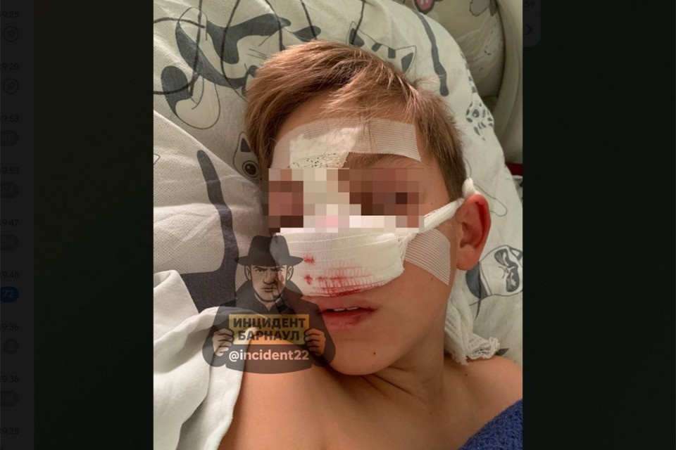    Пострадавшего мальчика прооперировали. Скриншот ТГ-канала "Инцидент Барнаул"
