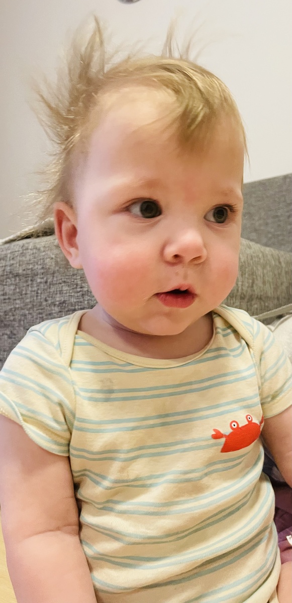 Снимок от 8 марта. Сейчас мне кажется, что он уже какой-то одутловатый что-ли...