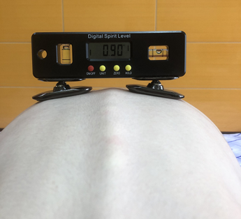 Сколиометр. Модификация центра Лечени и Диагностики забоеваний позвоночника и суставов, Люберцы