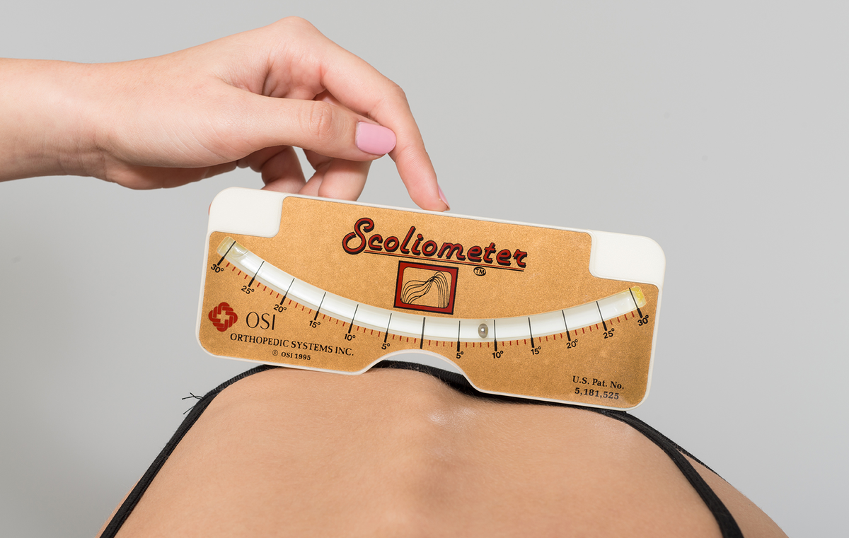 Сколиометрия при сколиозе с ротацией позвонков и деформацией ребер