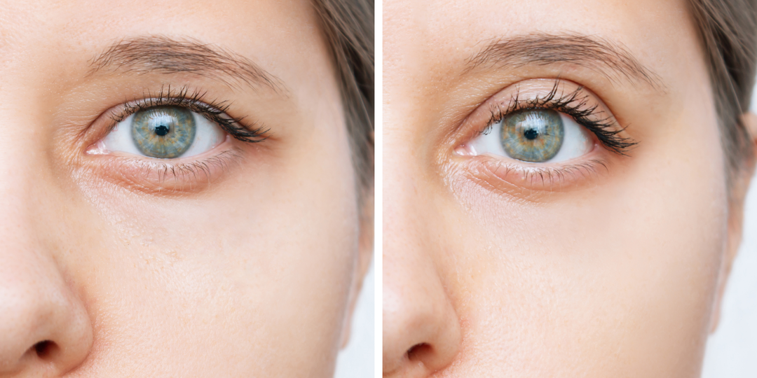 Верхнее веко подтягивается и взгляд молодеет - расслабляем одну мышцу в 3 приема