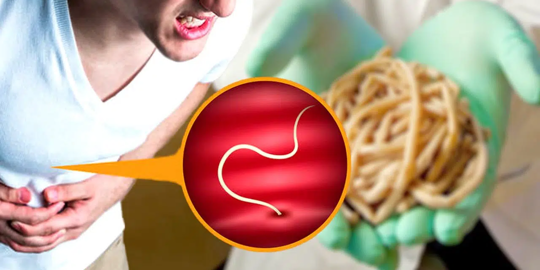 «Таблетки от паразитов лечат рак?» Где правда, а где опасный миф