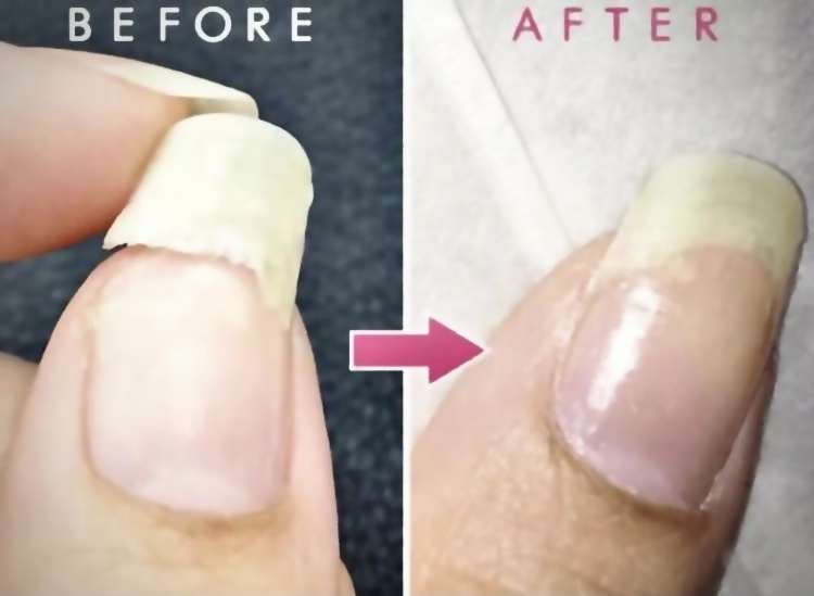 До и после применения.