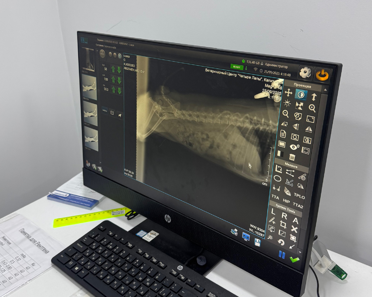 Рентген в нашем случае не показал результат, поскольку материал соски не контрастный, решено было делать УЗИ