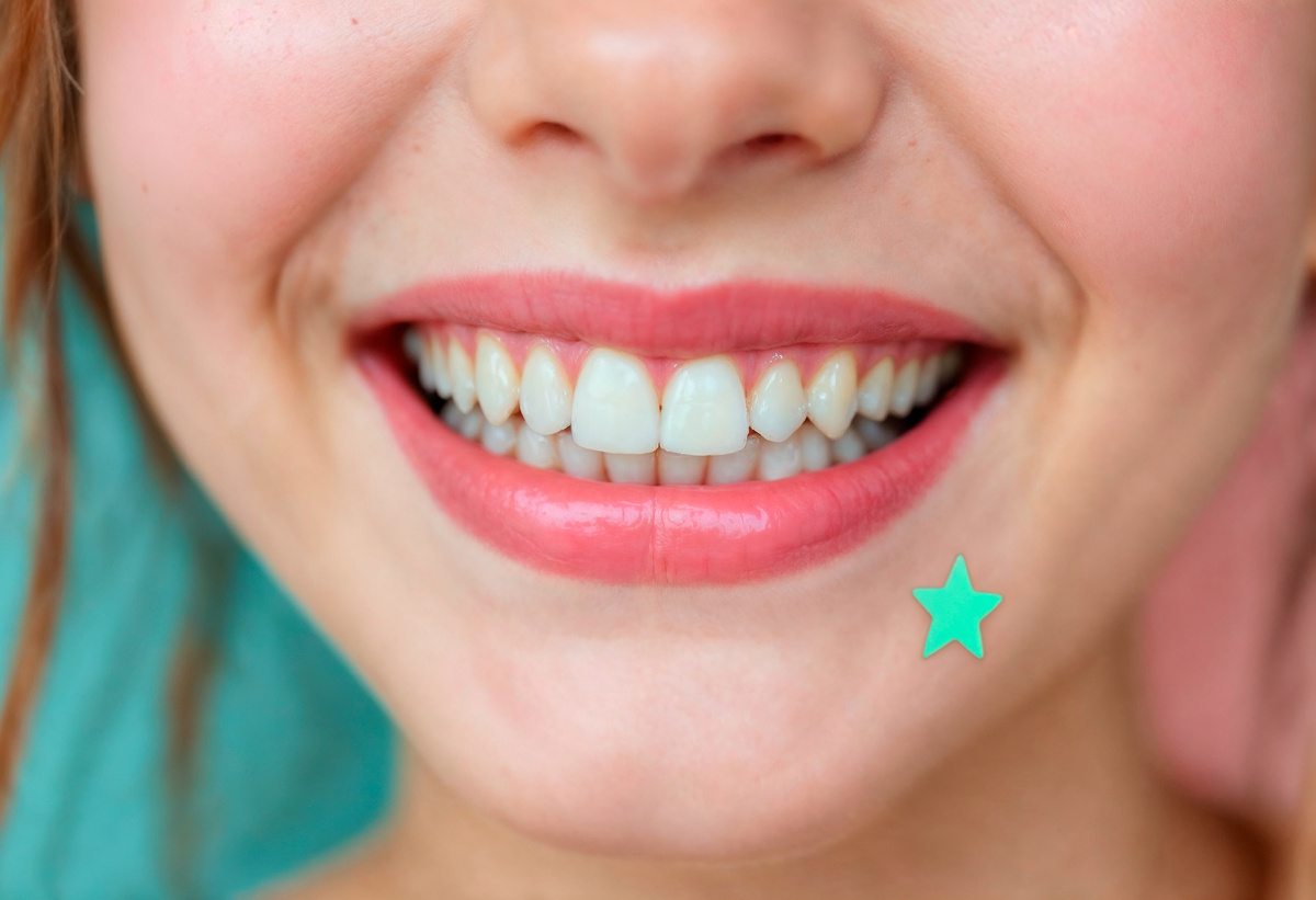 Здоровая улыбка