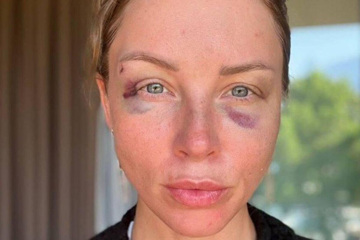    Полина Диброва Соцсети