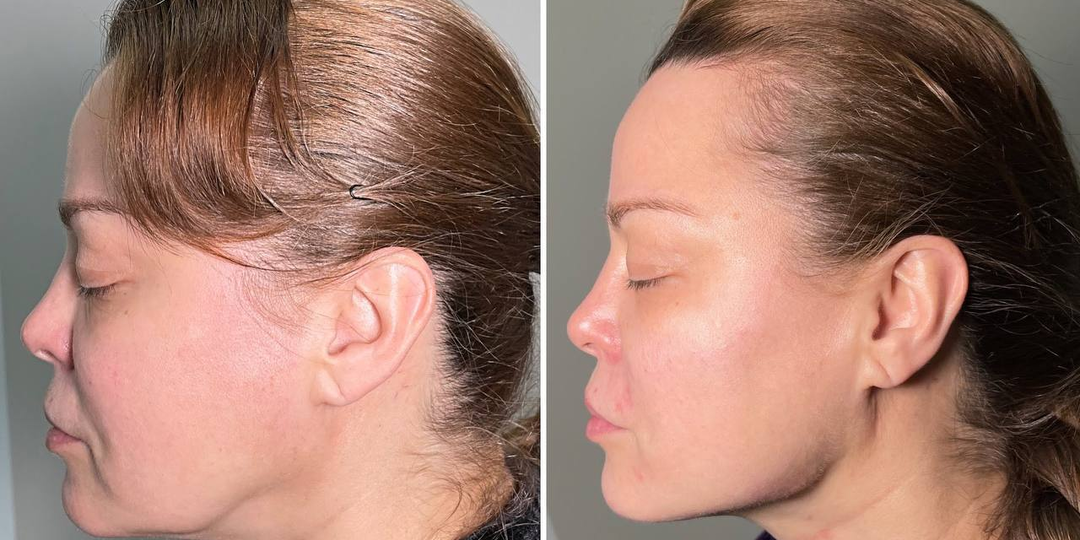 Как стресс влияет на кожу?