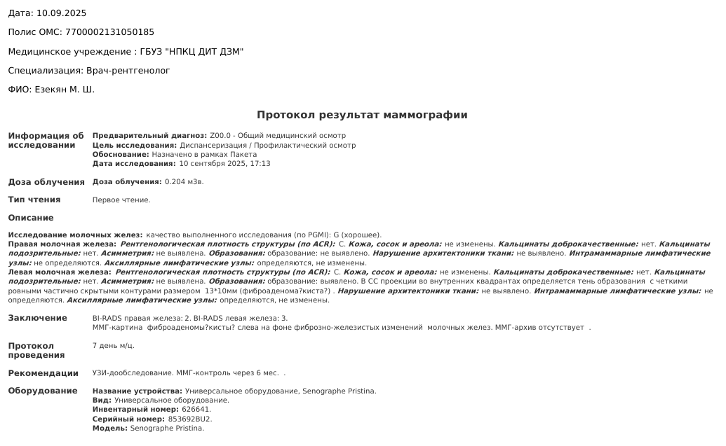 В левой груди фиброаденома/ киста 13*10 мм.