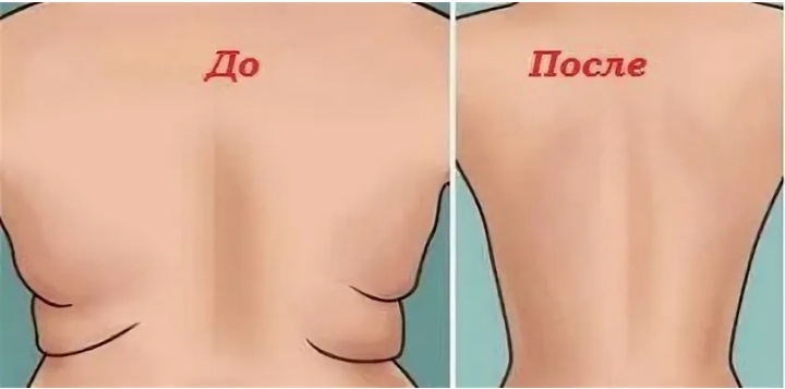 К сожалению реальные фото такого плана запрещены на площадке дзен