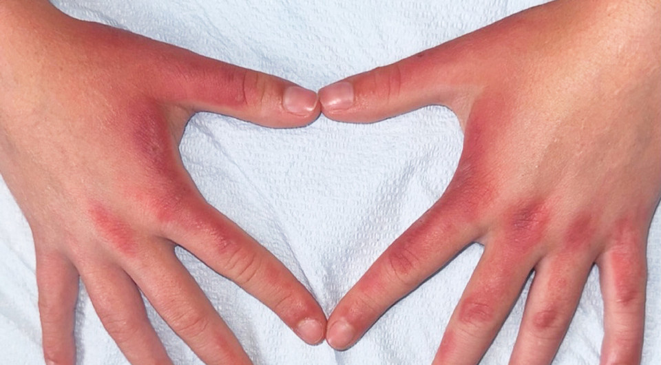   Grace Boyd, Carol Cheng / NEJM, 2025