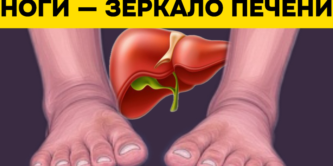 Ваши ноги могут рассказать о печени: какие признаки важно не пропустить