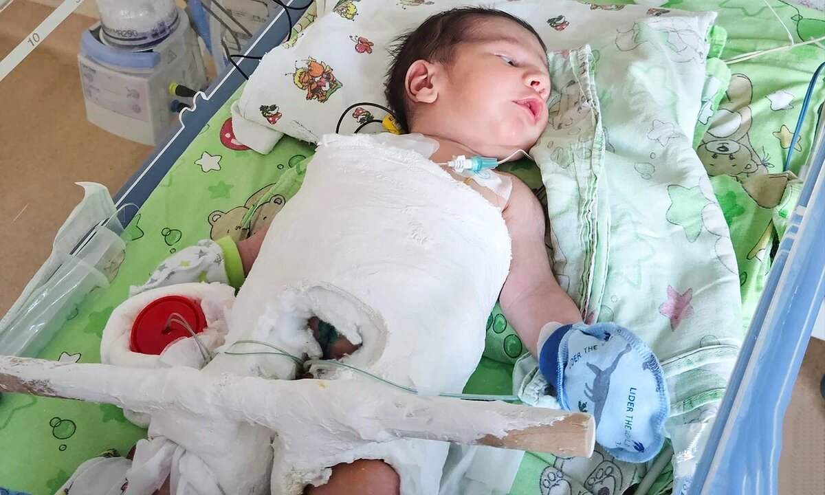 Карим Бахшиев, подопечный фонда «Алёша»