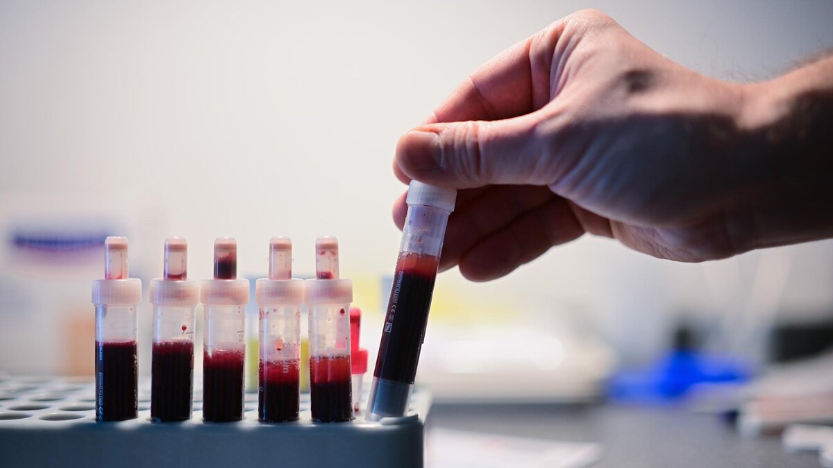 Фото: Sebastian Gollnow/globallookpress.com