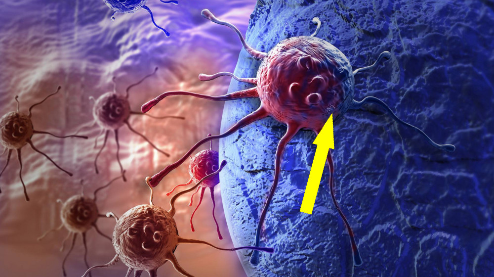    Диета может стать ключом к борьбе с смертельным раком мозга