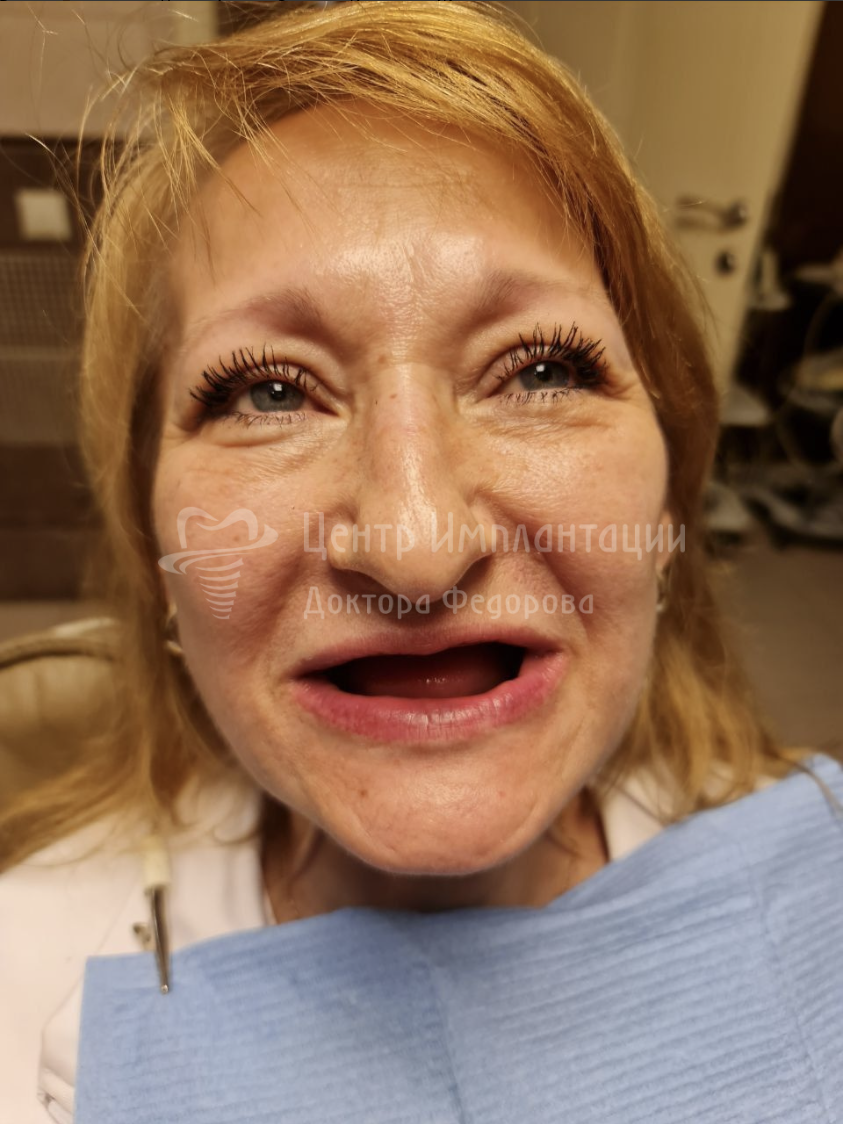 «Я ловила себя на том, что стараюсь меньше улыбаться. Комплексы из-за внешности сделали меня неуверенной, и казалось, будто я выгляжу гораздо старше своих лет.»