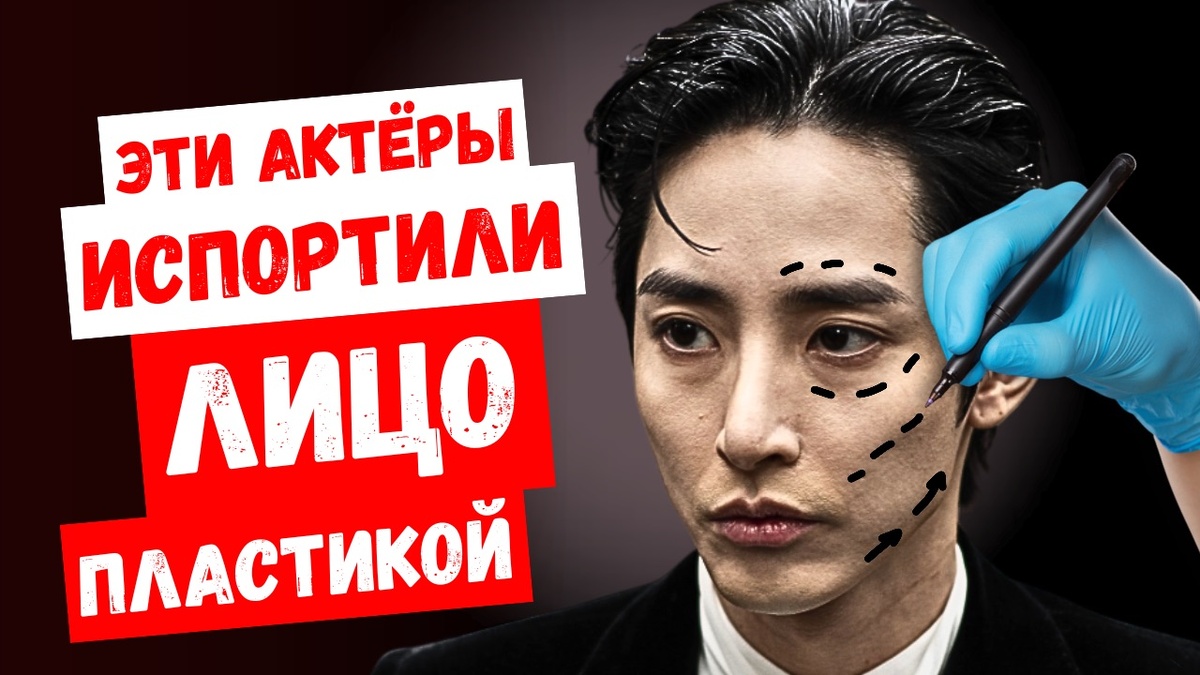 Теперь их не узнать! Корейские актёры, которые не смогли сохранить свою природную красоту