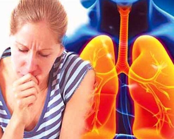 Туберкулёз. 