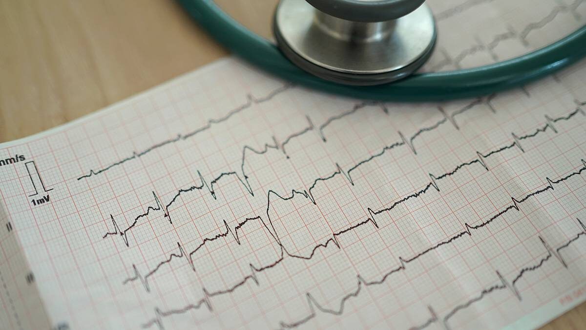    Фото: Shutterstock