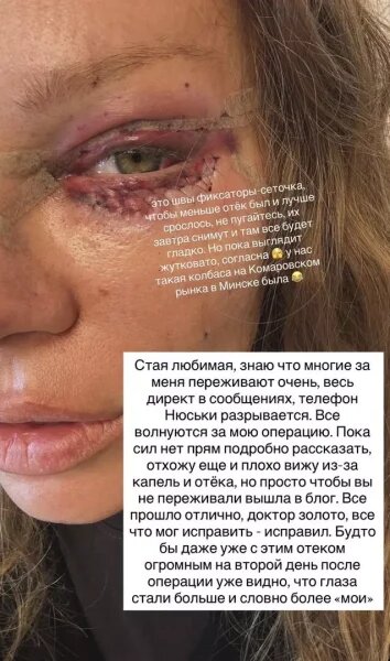    Рита Дакота, фото: соцсети