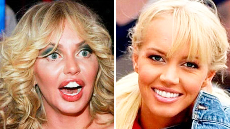 Маша Малиновская до и после пластики