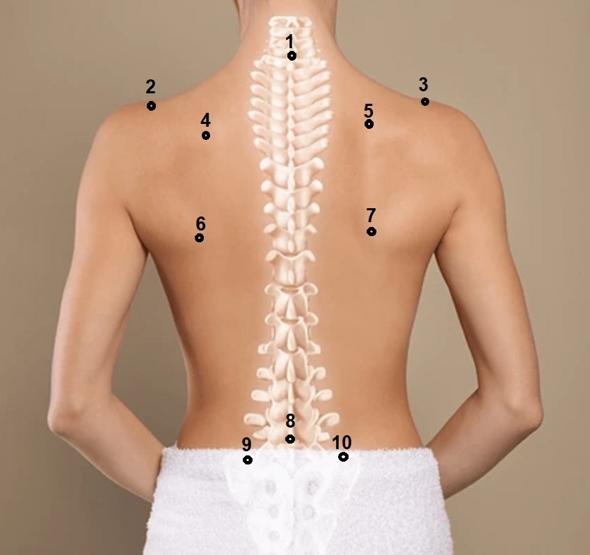 Анатомические ориентиры, используемые для измерения параметров поверхности спины при оптической топографии и при самотоятельном фотографировании спины для самоконтроля.