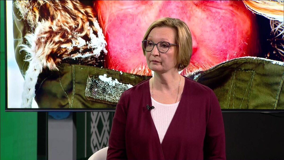    В программе «Здоровая среда» рассказали, как отличить реакцию на холод от аллергии