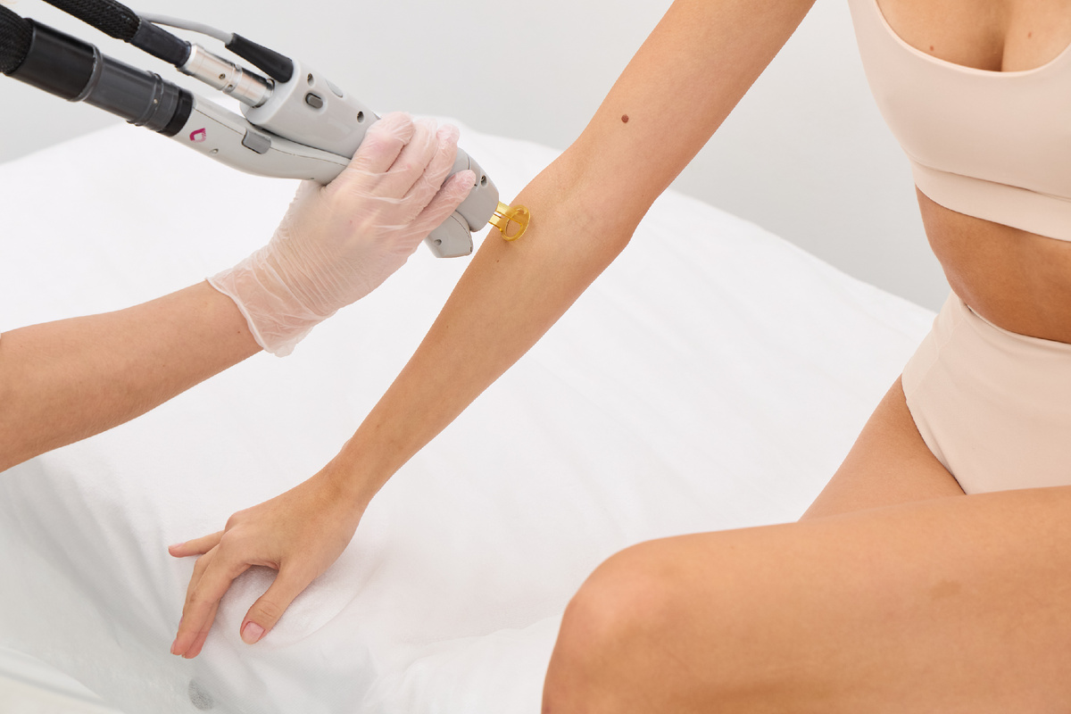 Пушковые волосы не всегда реагируют на лазер — и это нормально