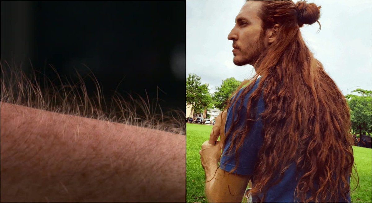    Почему волосы на голове и руках/теле так по-разному растут? Источники изображений: seminar-beauty.ru, ru.pinterest.com