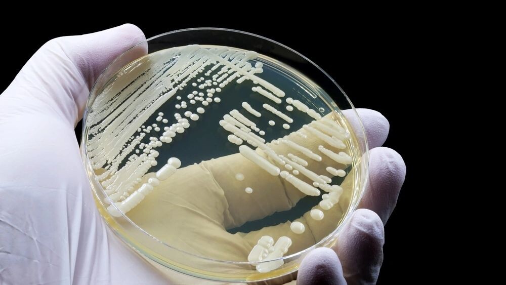    Фото: TopMicrobialStock/Shutterstock/Fotodom