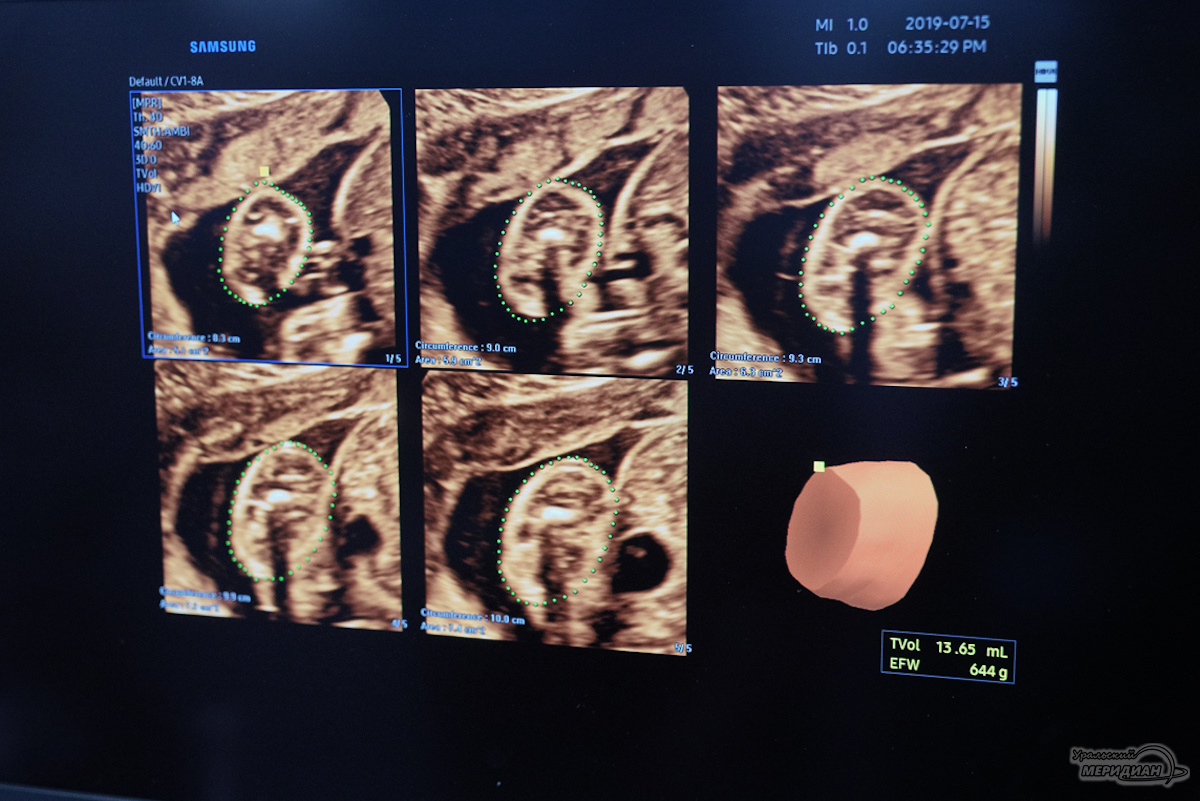    Фото: Лидия Аникина © ИА «Уральский меридиан»