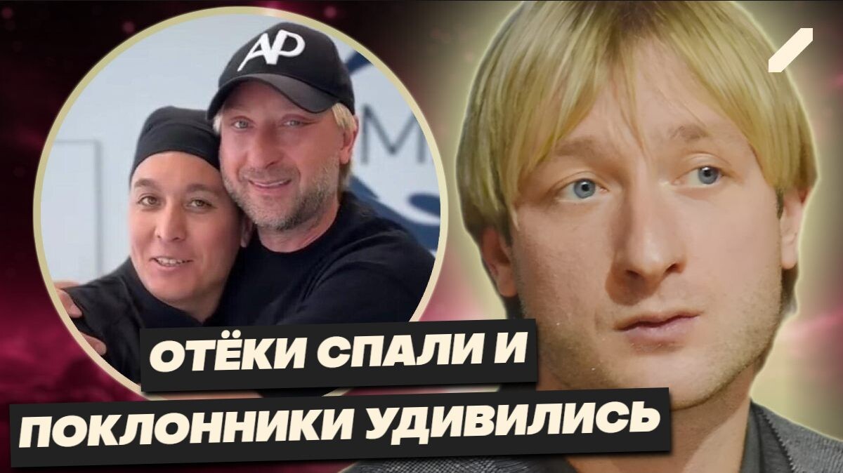 Евгений Плющенко после операции: как изменилось лицо легендарного фигуриста и почему его решение вызвало бурю споров