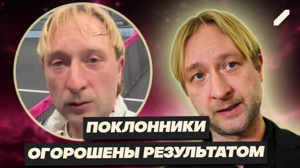 "Новое" лицо Плющенко оценили не все поклонники: "Раньше было лучше"