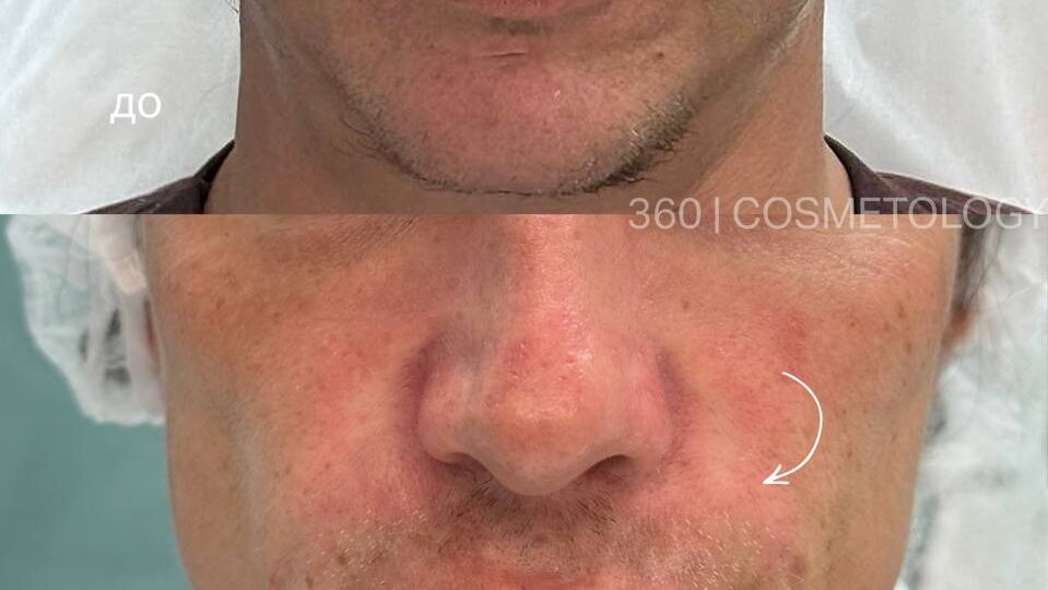 Хотите узнать, какая процедура была проведена и сколько она стоит