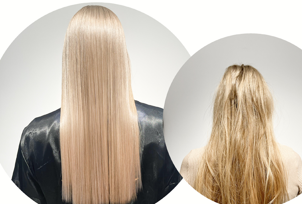 Результат процедуры BioBotox от Floractive