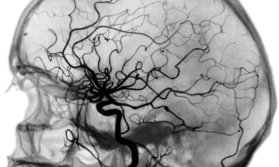 Рабочего давления не существует. Как миф убивает мотивацию лечиться