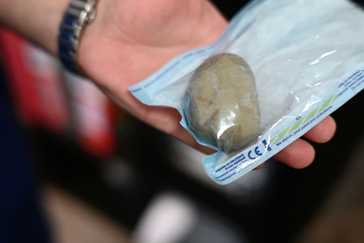    Фото: министерство здравоохранения Свердловской области