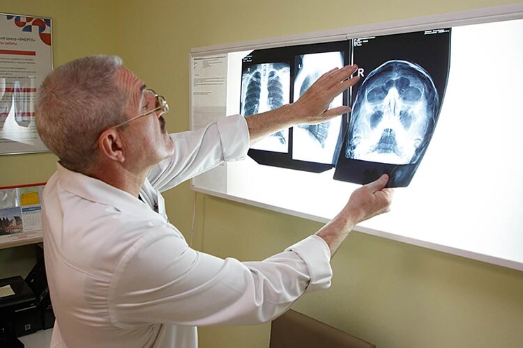 Рентгеновский снимок грудной клетки несет дозу облучения 30-50 мкЗв. Фото: Александр ГЛУЗ