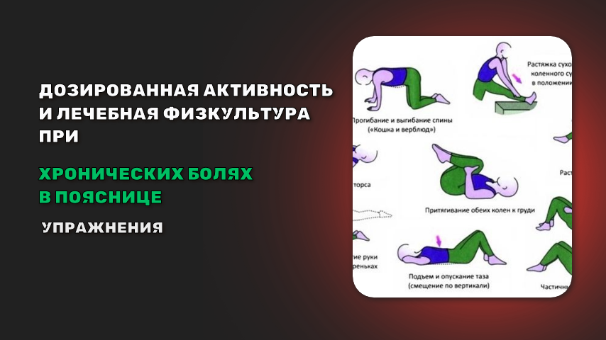 Дифференцированная активность и физическая реабилитация стали ключевыми элементами в лечении хронической боли в нижней части спины 