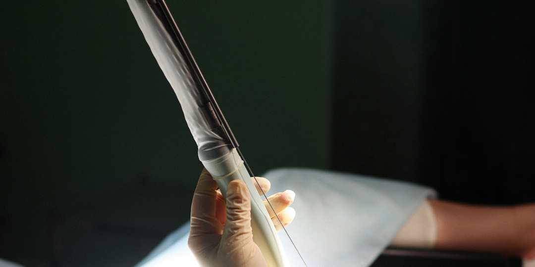 Что такое пункция яйцеклеток — личный опыт и советы