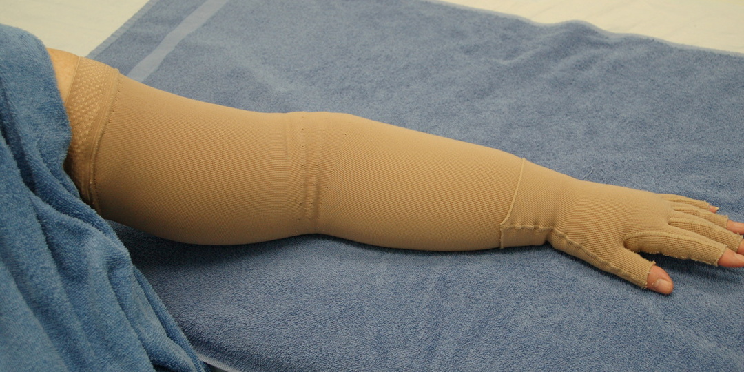 Лимфостаз и лимфедема: как активировать лимфодренаж и уменьшить отеки