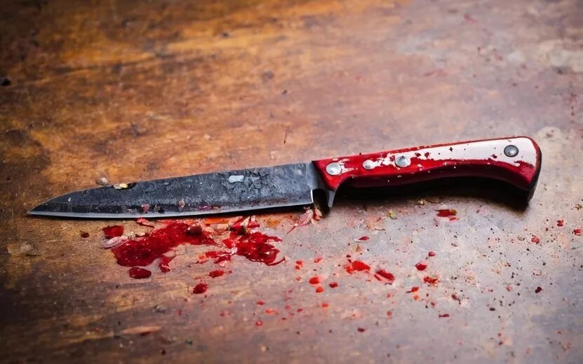    Житель Удмуртии ударил полицейского ножом по лицу