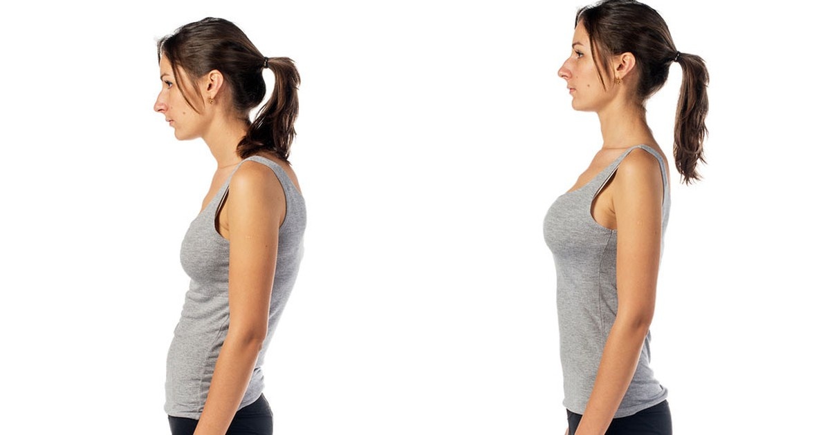 Сутулость — это нарушение осанки, при котором происходит формирование направленной назад выпуклости в грудном отделе позвоночника