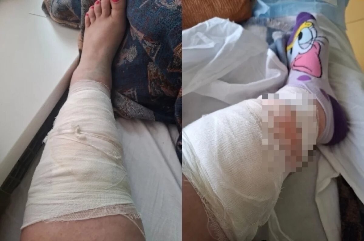    За одну неделю женщина перенесла три операции.