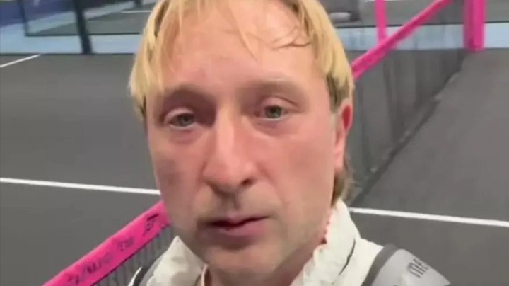 Евгений Плющенко, свежие кадры после пластической операции, 2025 год